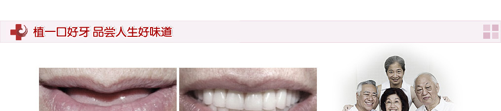 华美齿科牙齿种植真人案例对比图